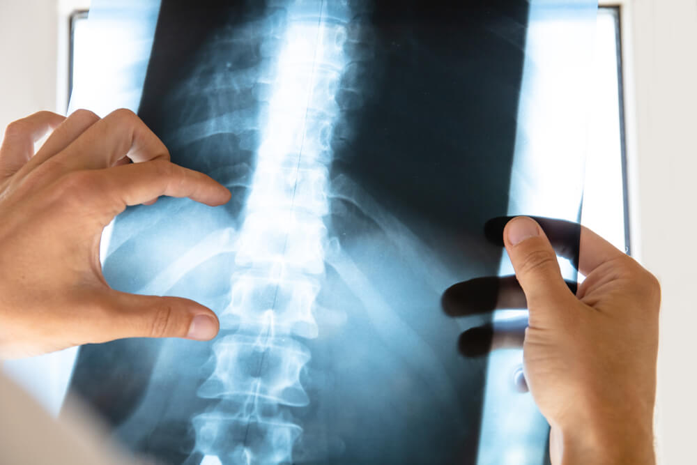 Causes Of Accidental Spinal Injuries