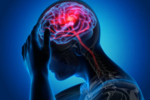 Man with a headache - Stroke -3D Illustration